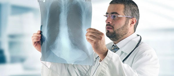 Médico viendo radiografía para informe respuesta motivada
